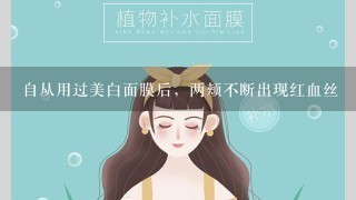 自从用过美白面膜后，两颊不断出现红血丝