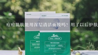 痘痘肌肤能用深层清洁面膜吗？用了以后护肤步骤如何