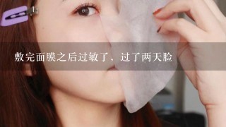 敷完面膜之后过敏了，过了两天脸