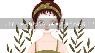 用了一次去角质的以后敷面膜和抹水乳鼻子两边和嘴唇