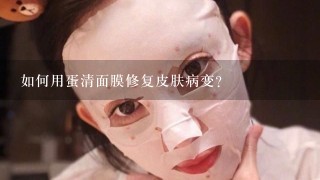 如何用蛋清面膜修复皮肤病变?